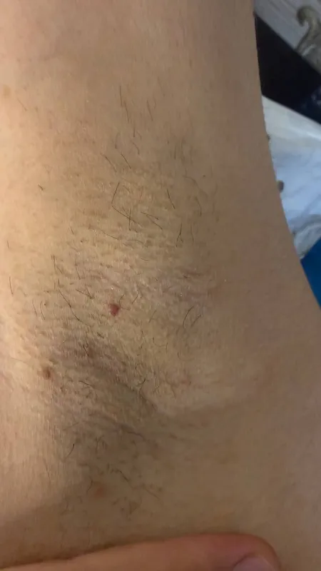 depilatsa 2