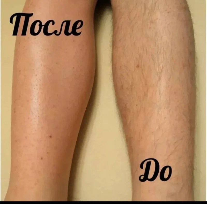 Депиляция мужчина и женщина — фото 3