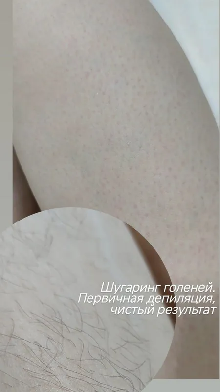 Депиляция для девушек! Шугаринг, полимерный воск! Более 3 лет стажа — фото 2