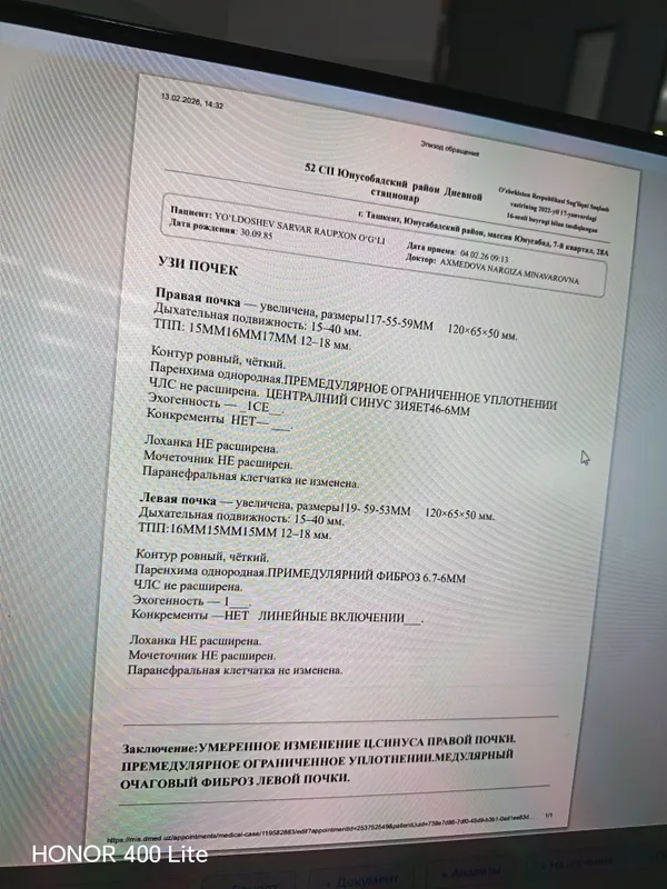 Фреза аппарат ускунаси 1
