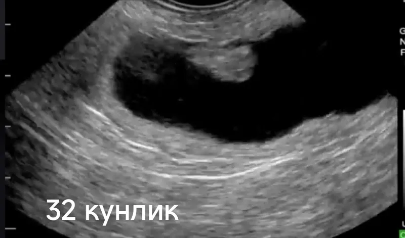 Узи диагностика хизмети 5 Узи диагностика хизмети 5