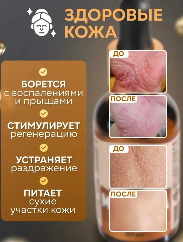 Монарда Лечебное масло. — фото 6