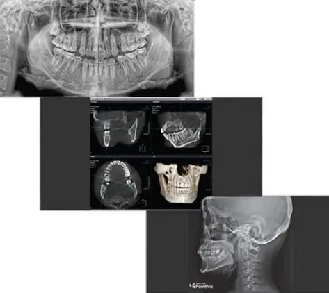 3D rentgen tish diagnostikasi | Morita 3
