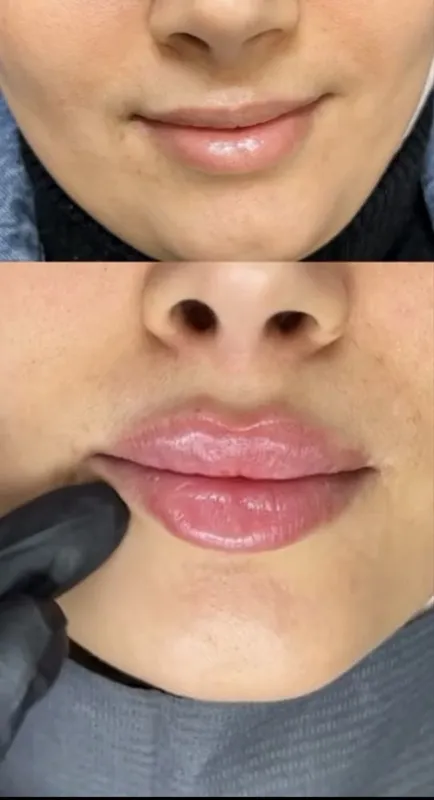 Muhabbat_cosmetolog Скидка хамма процедуралага 3