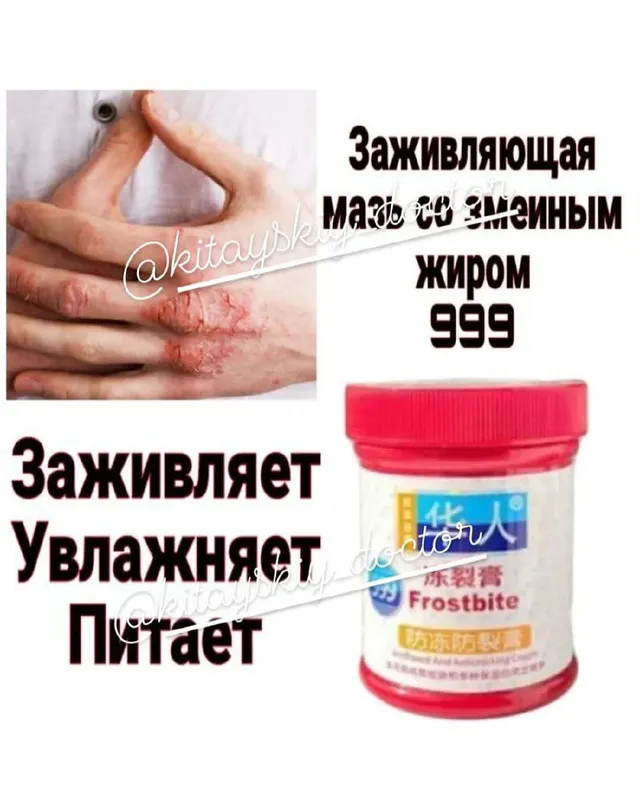 Sovuq va yorilgan teriga qarshi qo‘l uchun 999 malham