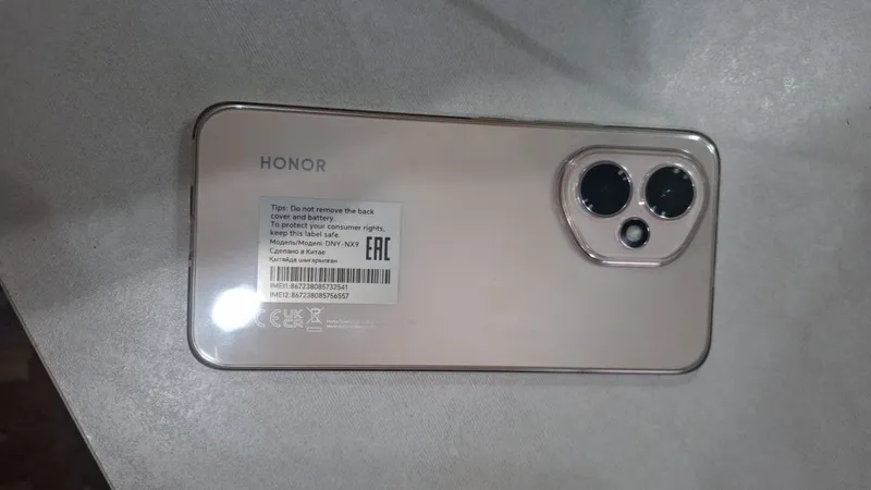 Honor 400 life