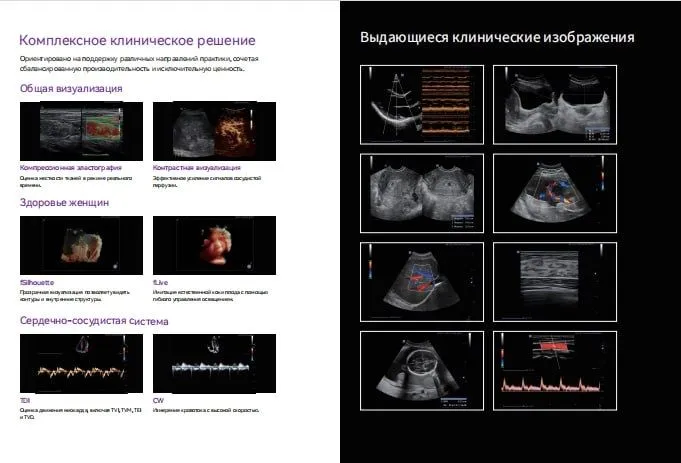 УЗИ, Кардио, ЭХО, Danus 30, Эластография 3