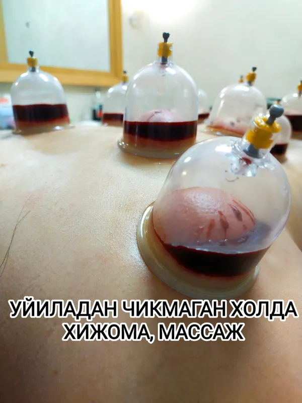 Аеллар массажи Хижома киламан — фото 3