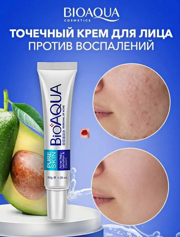 Aknega qarshi krem-Bioaqua krem