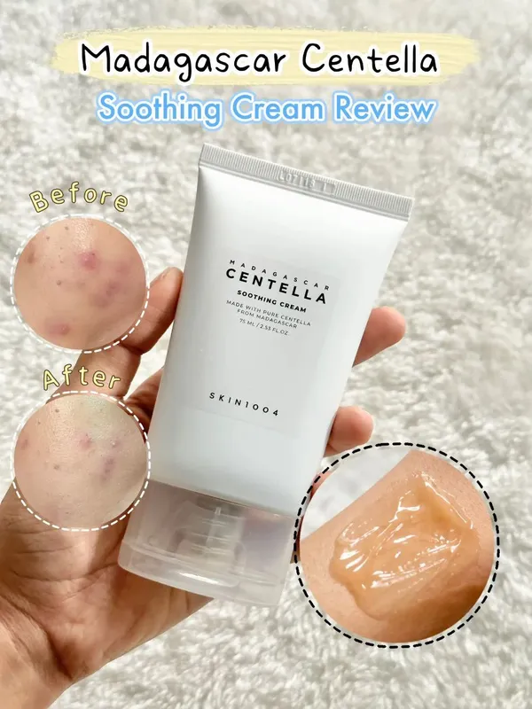 Centella aknega qarshi krem arginal 2
