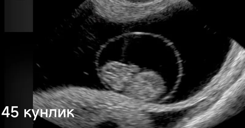 Узи диагностика хизмети 2 Узи диагностика хизмети 2
