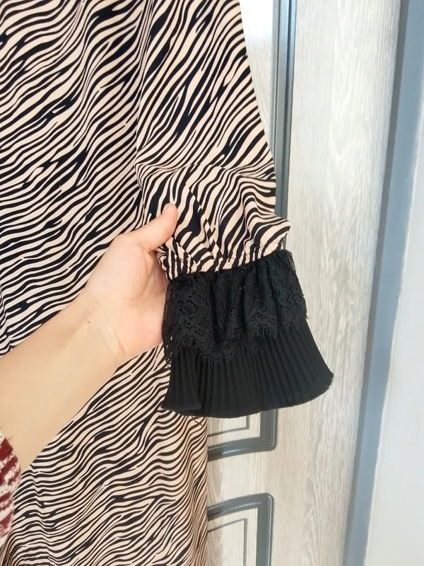 ayollar koʻylagi 2