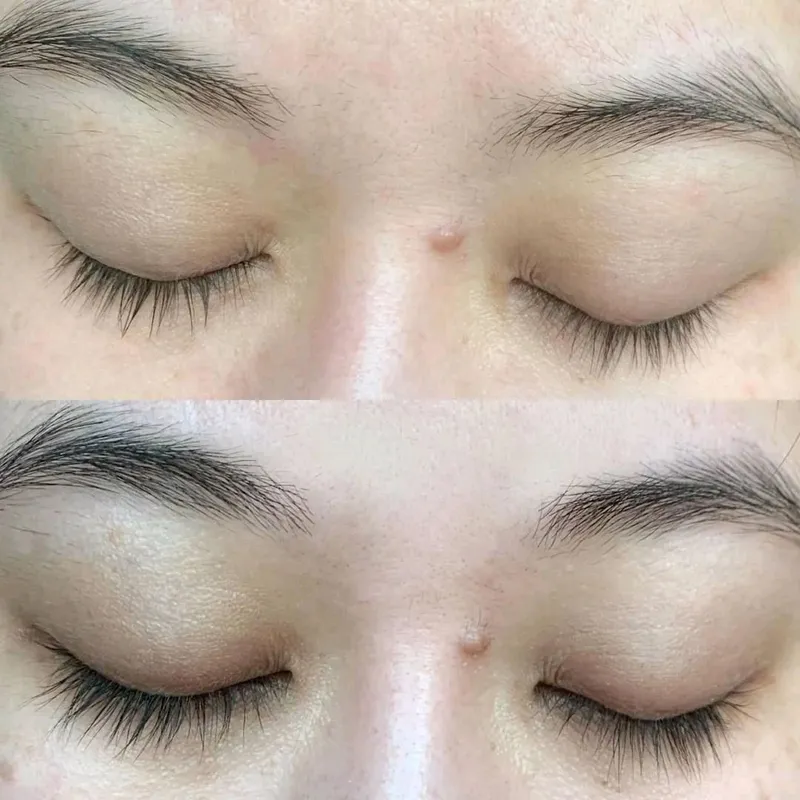 🇰🇷 My lash Serum. kiprik o'stiruvchi serum. — фото 1