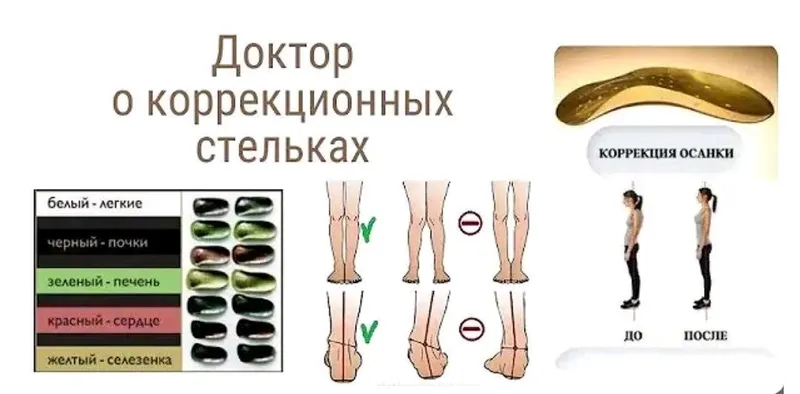 ОРТОПЕДИЧЕСКИЕ МАГНИТНО- АНИОНОВЫЕ СТЕЛЬКИ — фото 2