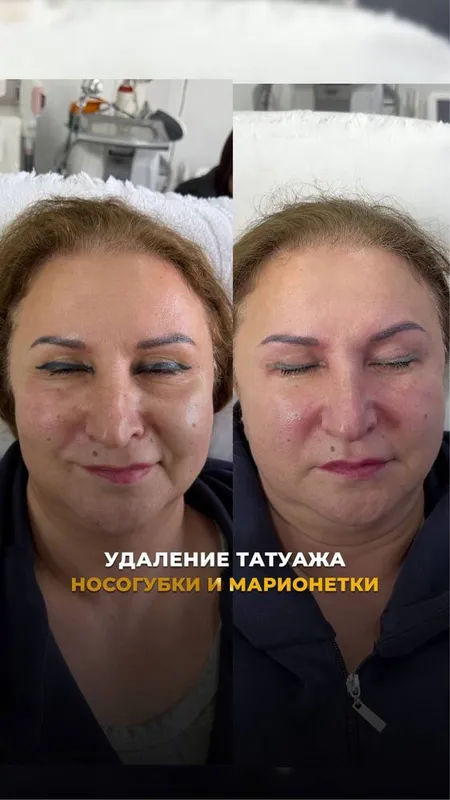 Услуги косметолога 3