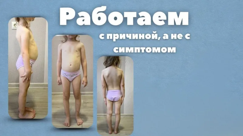лечебная физкультура на дому