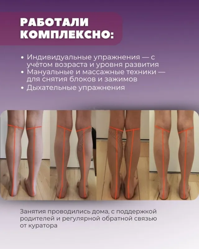 лечебная физкультура на дому — фото 1