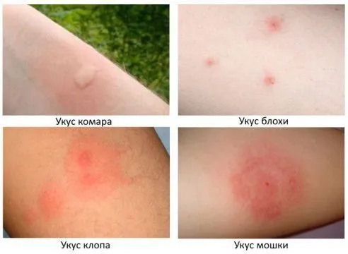 Дезинсекция квартир, домов и офисов 100% гарантия .Форма оплаты любая! 3 Дезинсекция квартир, домов и офисов 100% гарантия .Форма оплаты любая! 3