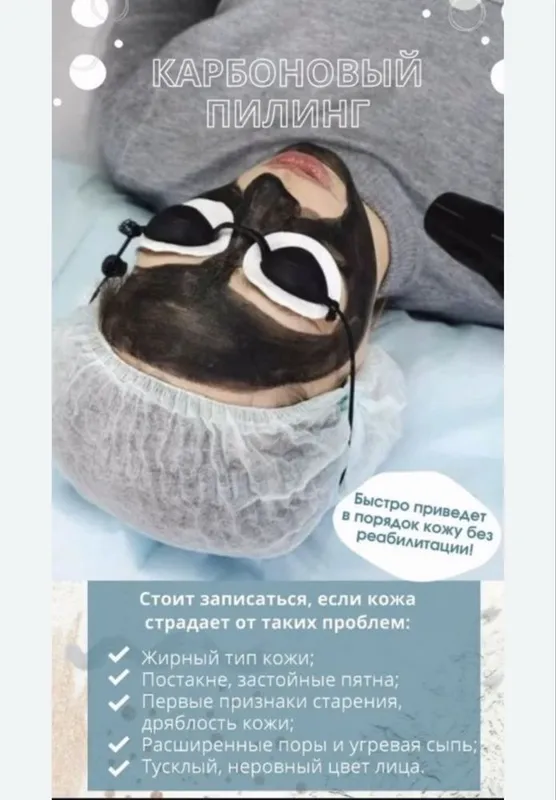 Лазерный аппарат для удаления . N yag lazer aparati. 3 Лазерный аппарат для удаления . N yag lazer aparati. 3