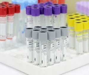Пробирка в наличие зелёный пробирка с гепарин гелем 3000 сум за шт 4