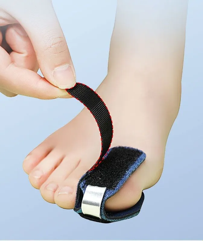 Oyoq barmoqlari uchun fiksator-ortez, gips o‘rniga korset 3 Oyoq barmoqlari uchun fiksator-ortez, gips o‘rniga korset 3