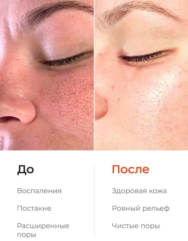 Likato Professional — энзимная пудра-пилинг для чувствительной кожи — фото 3 Likato Professional — энзимная пудра-пилинг для чувствительной кожи — фото 3