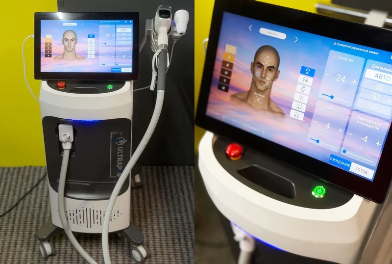 Professional diodli lazer «ULTRAPRO» 2026-yil 1 Professional diodli lazer «ULTRAPRO» 2026-yil 1