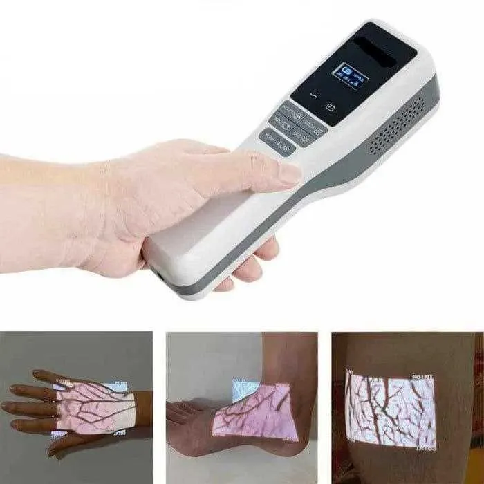 Venovizer | веновизор | Vein Finder top1