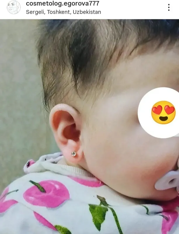 Прокалывание ушей — фото 4