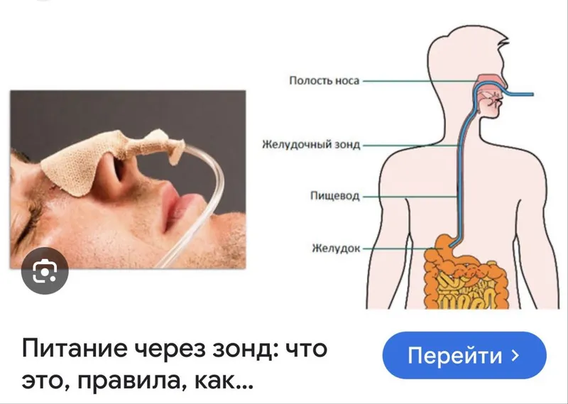 Установим центральный венозный катетер. Markaziy vena kateteri qo'yish — фото 2