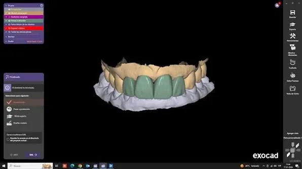 Exocad CAD/CAM | Zirkoniya va PMMA 3D modellar 5 Exocad CAD/CAM | Zirkoniya va PMMA 3D modellar 5