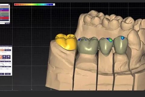 Exocad CAD/CAM | Zirkoniya va PMMA 3D modellar 6 Exocad CAD/CAM | Zirkoniya va PMMA 3D modellar 6