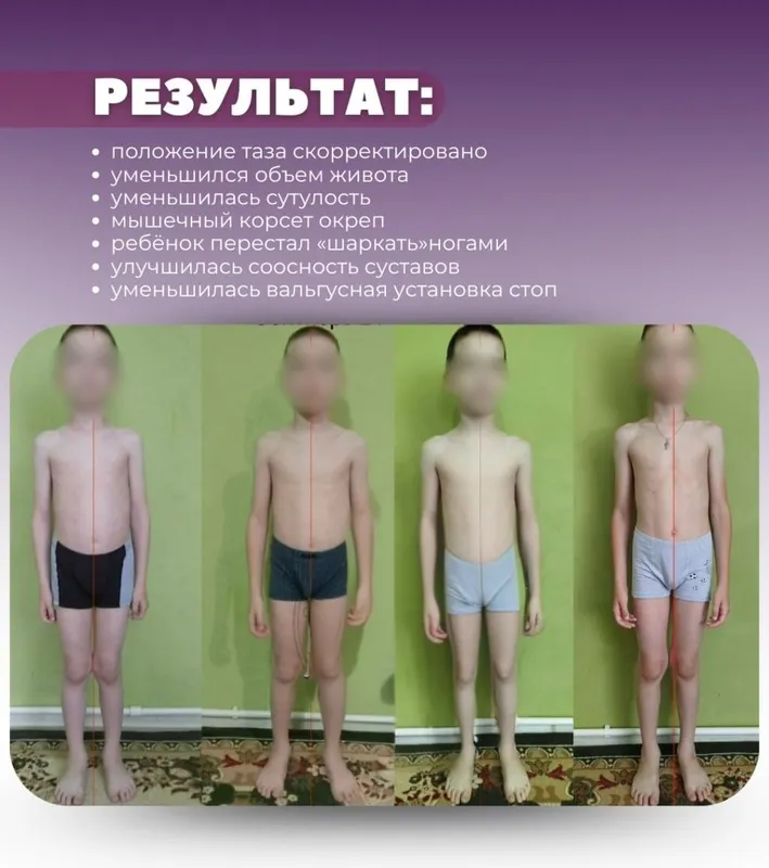 лечебная физкультура на дому — фото 2