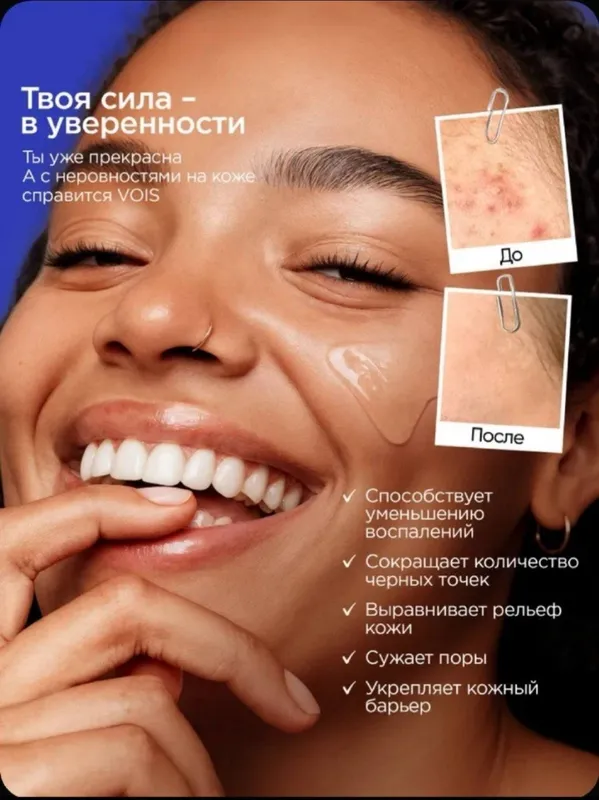 Сыворотка для ухода за кожей лица Vois, 30 мл 3 Сыворотка для ухода за кожей лица Vois, 30 мл 3