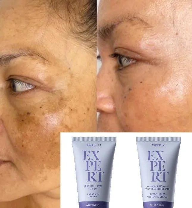 SPF 15 Expert bir zumda yorituvchi ta'sirga ega SPF 15 Expert bir zumda yorituvchi ta'sirga ega