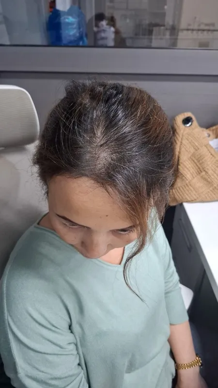 Kiprik narashka 100 min. soch boyash, ukladkaa — фото 4
