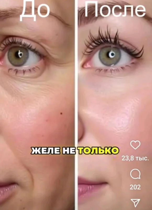 АНИОТОТЕРАПИЯ С АППАРАТОМ ВЕНТУН 1.0 — фото 3