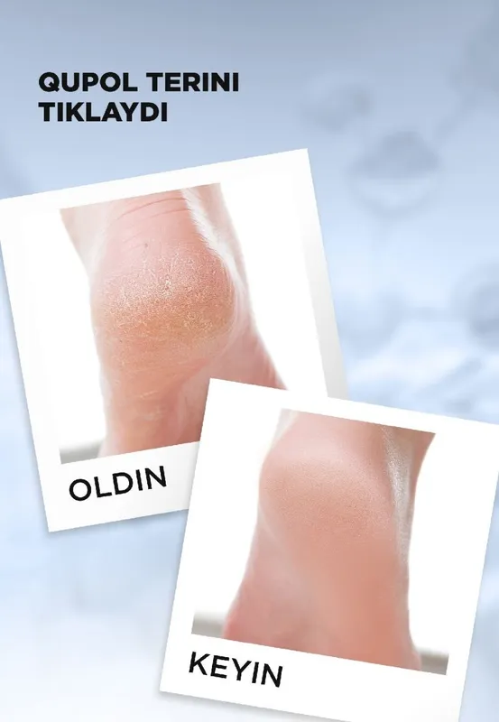 Quruq teri va yoriqlar uchun krem-mum (Expert Pharma) — фото 5