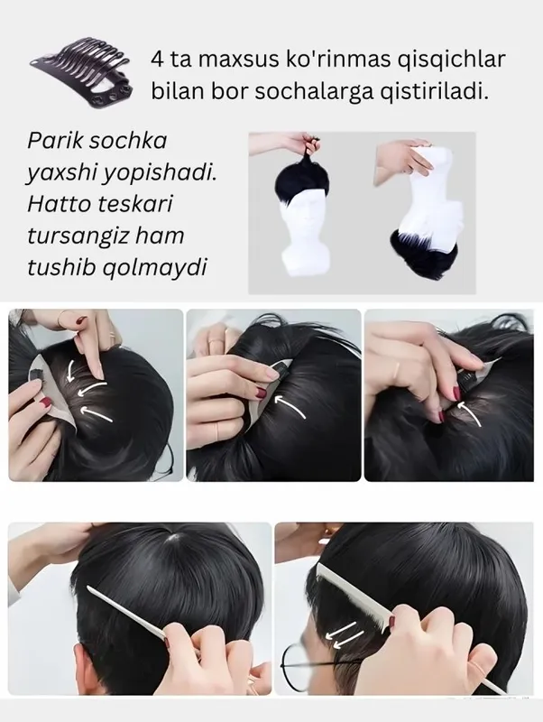 Erkaklar uchun soch protezi, soch tizimi 5