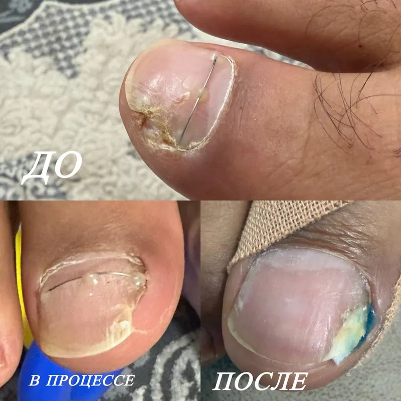 Этга усган тирноклар — фото 2