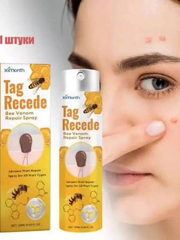 Tag Recede papilomalar uchun