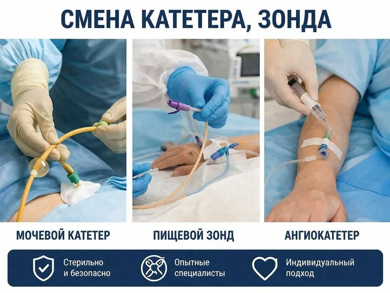 замена мочевого катетора
