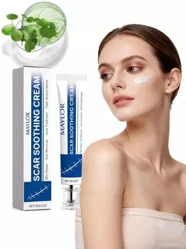 Scar Soothing Cream chandiq, striya Scar Soothing Cream chandiq, striya