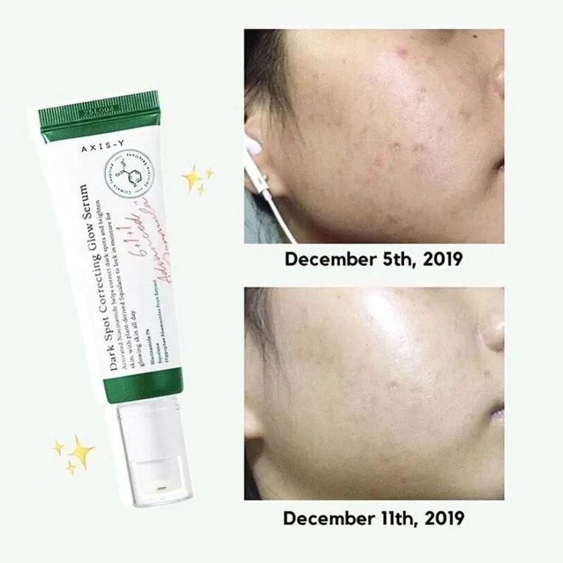 Axis-y serum