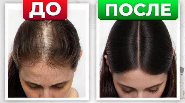 Уход