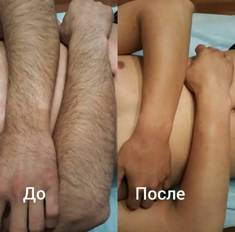 Депиляция всех зон для мужчин 2 Депиляция всех зон для мужчин 2
