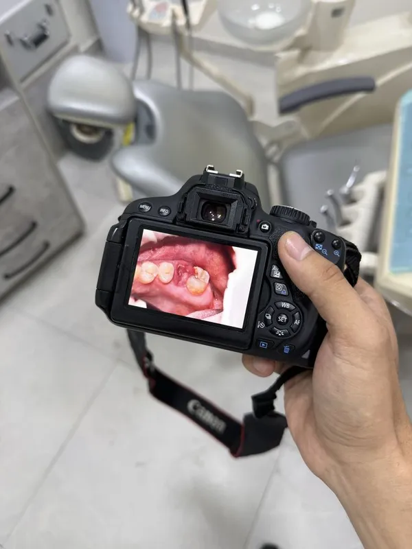 Canon eos 650 фотоаппарат 1