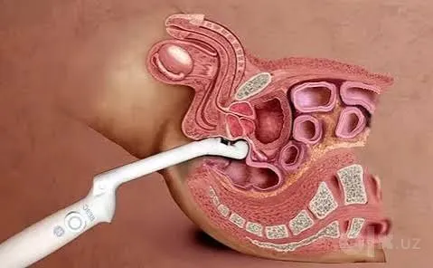 Massaj prostata premier 2 Massaj prostata premier 2