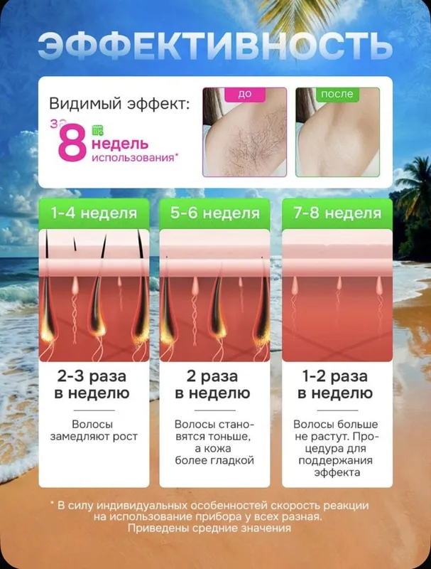 Лазерный эпилятор 5 Лазерный эпилятор 5