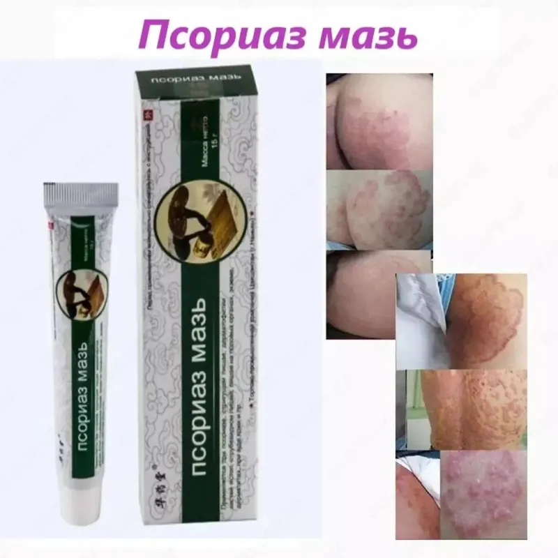 «Psoriaz» malhami «Psoriaz» malhami